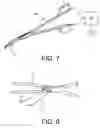 Fig. 06 - Microwave coaptive surgical sealing tool