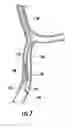 Fig. 08 - Catheter control system and graphical user interface