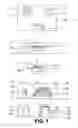 Fig. 02 - Removable lingual-vestibular dental alignment device and method for production thereof