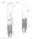 Fig. 01 - RETENTION ELEMENT FOR ATTACHING A FIRST DENTAL COMPONENT TO A SECOND DENTAL COMPONENT AND DENTAL ASSEMBLY COMPRISING THE RETENTION ELEMENT