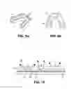 Fig. 06 - LIGHT CURING IMPRESSION SYSTEM