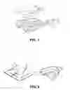 Fig. 02 - LIGHT CURING DENTAL SYSTEM