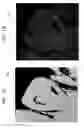Fig. 08 - Occlusal state identifying method, occlusal state identifying apparatus, and storage medium
