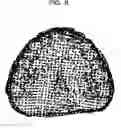 Fig. 09 - Occlusal state identifying method, occlusal state identifying apparatus, and storage medium