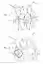 Fig. 02 - Vascular prosthesis for treating aneurysms