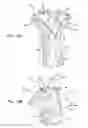 Fig. 09 - Vascular prosthesis for treating aneurysms