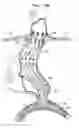 Fig. 33 - Vascular prosthesis for treating aneurysms