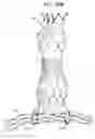 Fig. 40 - Vascular prosthesis for treating aneurysms