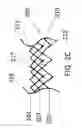 Fig. 06 - Replacement mitral valves