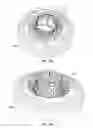 Fig. 35 - Replacement mitral valves