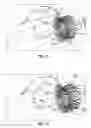 Fig. 40 - Replacement mitral valves