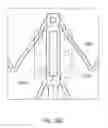 Fig. 43 - Replacement mitral valves