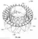 Fig. 45 - Replacement mitral valves