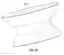 Fig. 63 - Replacement mitral valves