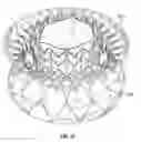 Fig. 77 - Replacement mitral valves