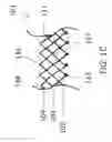 Fig. 04 - Replacement mitral valves