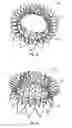 Fig. 09 - Replacement mitral valves