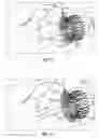 Fig. 40 - Replacement mitral valves