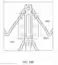 Fig. 43 - Replacement mitral valves
