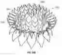 Fig. 46 - Replacement mitral valves