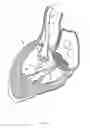 Fig. 07 - Methods and apparatus for endovascularly replacing a heart valve