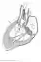 Fig. 09 - Methods and apparatus for endovascularly replacing a heart valve