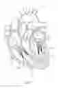 Fig. 02 - Chordae tendineae adjustment