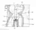 Fig. 01 - Heart valve repair devices and methods