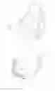 Fig. 06 - Asymmetric artificial knee joint