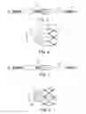 Fig. 03 - Delivery systems and methods of implantation for prosthetic heart valves
