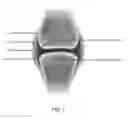 Fig. 02 - USE OF AN INJECTABLE ANTIMICROBIAL COMPOSITION FOR THE PREVENTION AND/OR TREATMENT OF OSTEOARTHRITIS