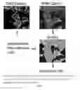 Fig. 02 - Pyrazolopyridazines and methods for treating retinal-degenerative diseases and hearing loss associated with usher syndrome