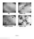 Fig. 17 - Compounds and compositions for ossification and methods related thereto