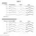 Fig. 06 - Composition for optic nerve protection