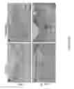 Fig. 11 - Soy-derived bioactive peptides for use in compositions and methods for wound healing, tissue engineering, and regenerative medicine