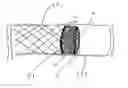 Fig. 01 - Coated endovascular devices