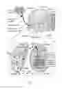 Fig. 08 - Hybrid implant system and manufacturing method therefor