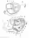 Fig. 02 - Device and a method for augmenting heart function
