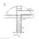 Fig. 01 - CONTINUOUS SUBCUTANEOUS INSULIN INFUSION CATHETER