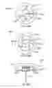 Fig. 40 - CONTINUOUS SUBCUTANEOUS INSULIN INFUSION CATHETER