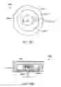 Fig. 41 - CONTINUOUS SUBCUTANEOUS INSULIN INFUSION CATHETER