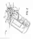 Fig. 03 - Magnetic pressure sensing system for an infusion pump