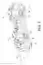 Fig. 04 - Magnetic pressure sensing system for an infusion pump