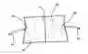Fig. 01 - Insufflation stabilization system