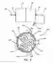 Fig. 03 - Insufflation stabilization system