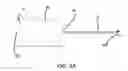 Fig. 04 - Insufflation stabilization system