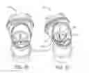 Fig. 07 - Fluid coupling conduit for a patient interface device