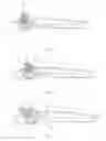 Fig. 04 - Tracheoscope