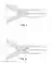 Fig. 04 - Cervical canal dilation device