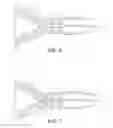 Fig. 05 - Cervical canal dilation device